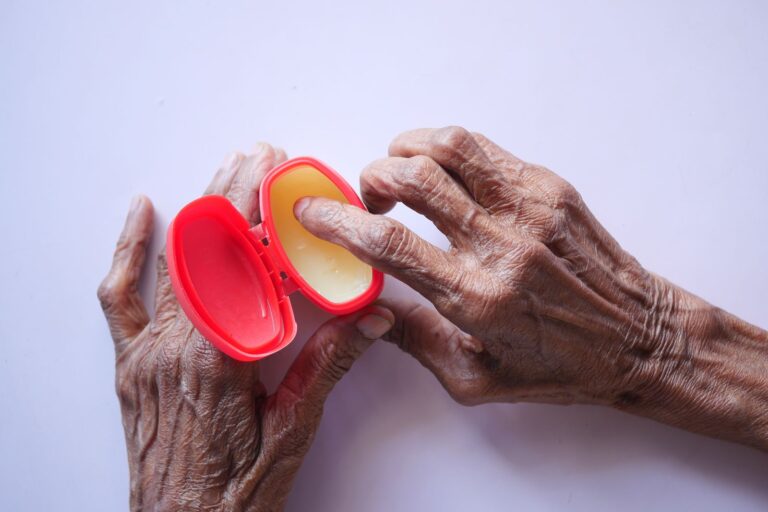 Mains âgées appliquant de la crème